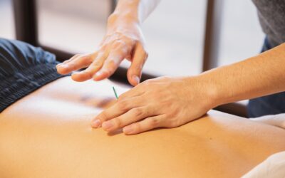 Unveiling the Art of Acupuncture: Exploring Holistic Pain Management