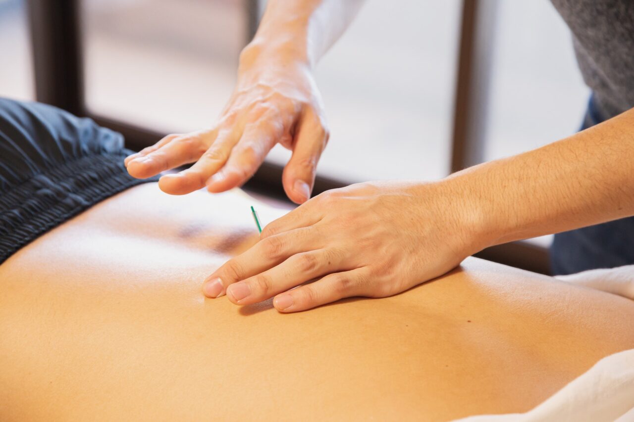 Acupuncture services at Body Mechanix